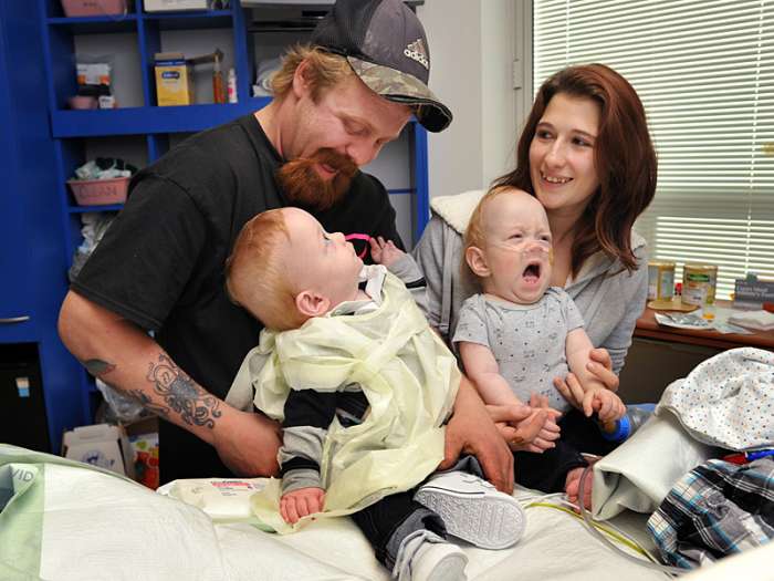Formerly conjoined twin heads home year after birth, brother still recovering